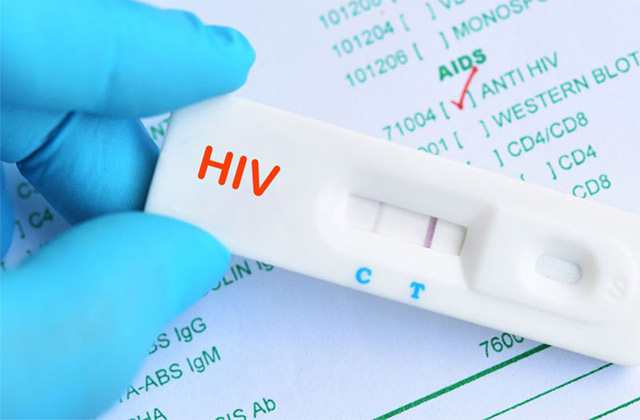 Những đối tượng nào sẽ được hưởng chế độ khi bị nhiễm HIV?